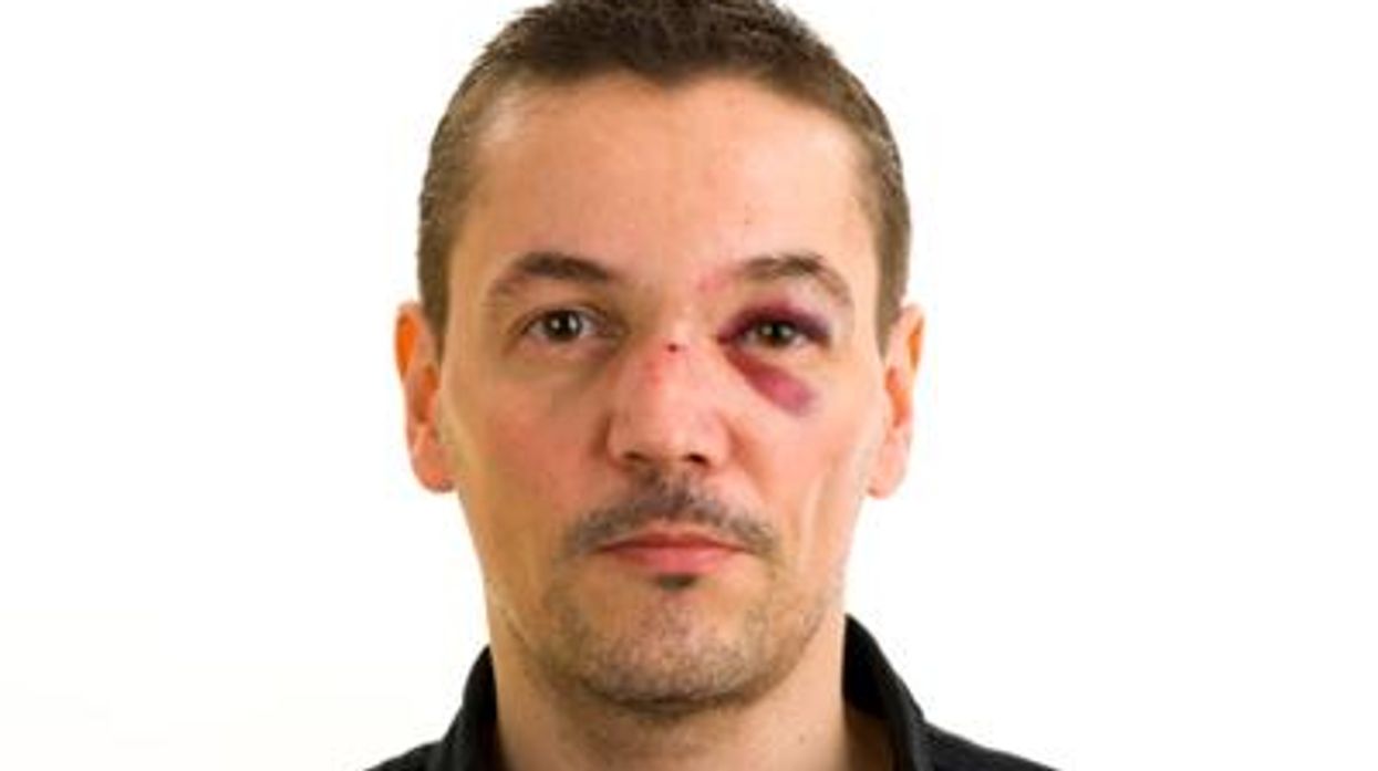 Domesticviolencex400_advocate_0