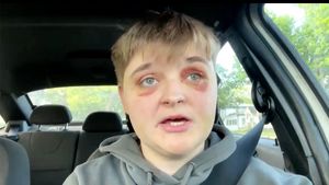 Lesbian teen brutally beaten at Illinois McDonald's in potential hate crime